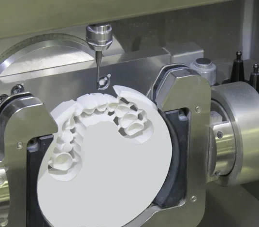 Dente pulito da un cottonfioc